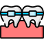 Inline Aligners